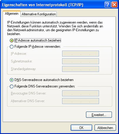 Stellen Sie sicher, dass die Optionen "IP-Adresse automatisch beziehen" und "DNS-Serveradresse automatisch beziehen" ausgewählt sind.
Klicken Sie auf "OK" und starten Sie Ihren Computer neu.